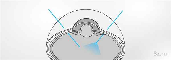 Витрэктомия — 3Z