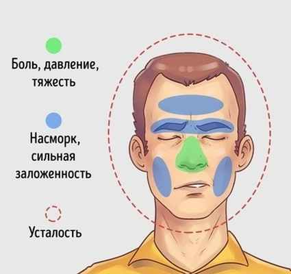 гайморит симптомы