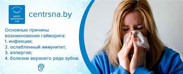 Причины гайморита. Аллергический гайморит