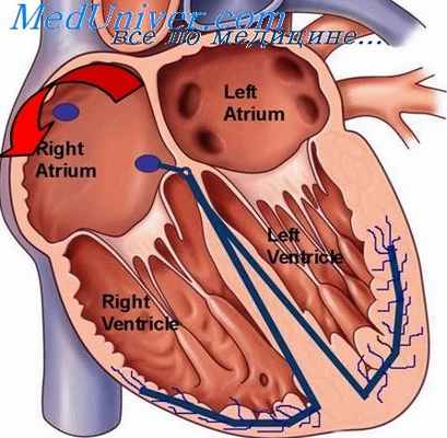 релаксация миокарда