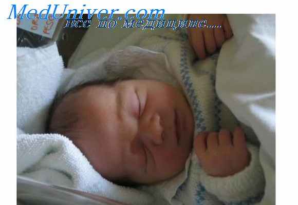 сердечная недостаточность