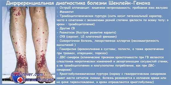 Дифференциальная диагностика болезни Шенлейн-Геноха