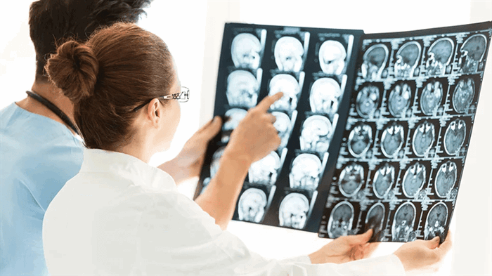 Диффузное аксональное повреждение головного мозга (вопросы визуализации)