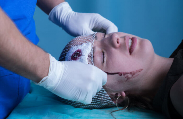 Дислокация головного мозга