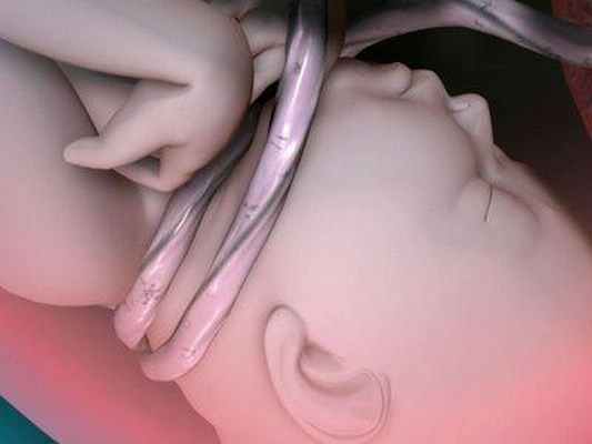 Гипоксия плода: что это и каковы ее причины?