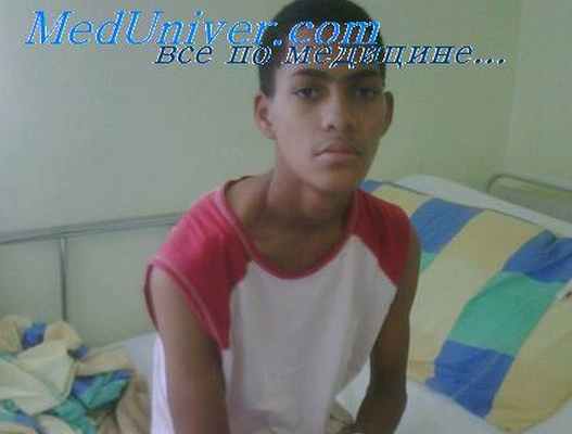 судороги у пациента