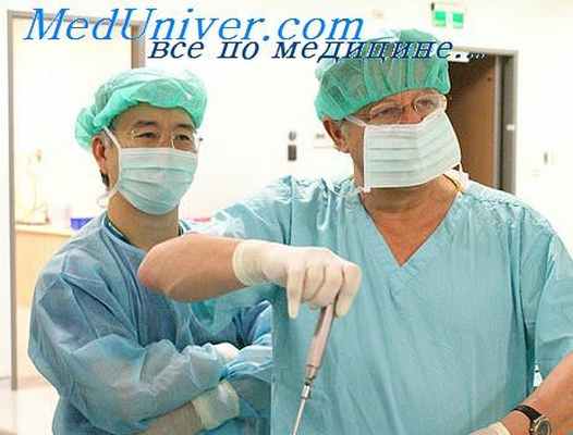 аденомэктомия