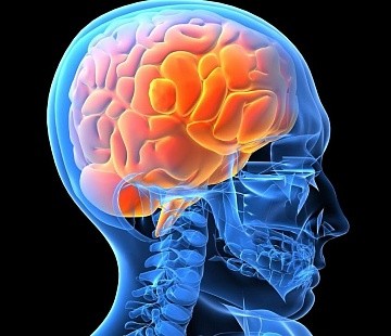 Фото Джексоновская эпилепсия