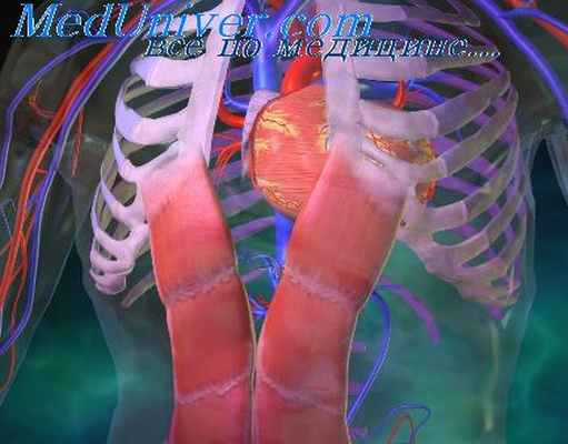 перевязка легочной артерии