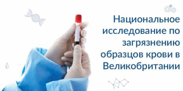 Национальное исследование по загрязнению образцов крови в Великобритании
