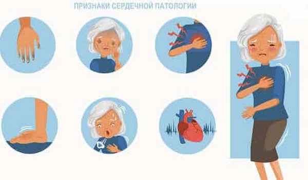 Симптомы сердечной патологии