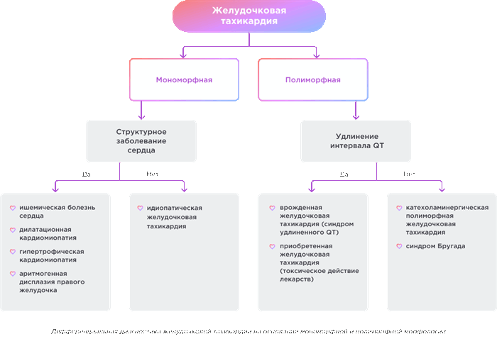 Дифференциальная диагностика желудочковой тахикардии на основании мономорфной и полиморфной морфологии