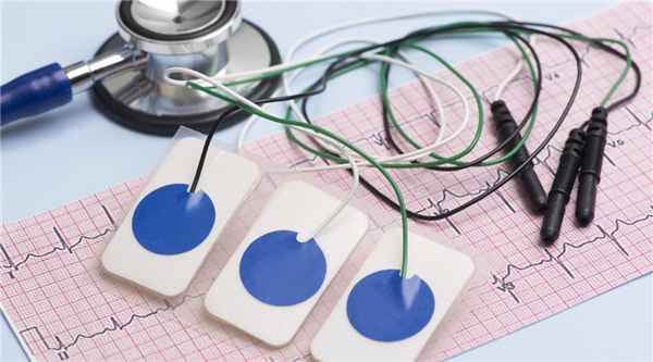 Брадикардия (синусовая)