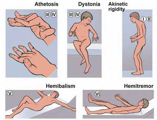 Все нарушения