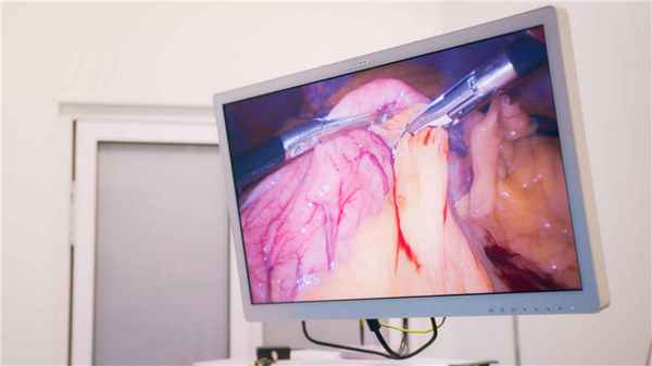 кровотечение жкт