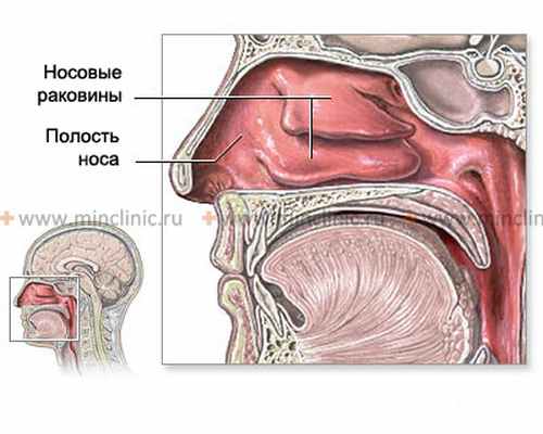 Фурункул носа чаще всего располагается на его крыльях, в преддверии носа, на верхней губе и носогубной складке.