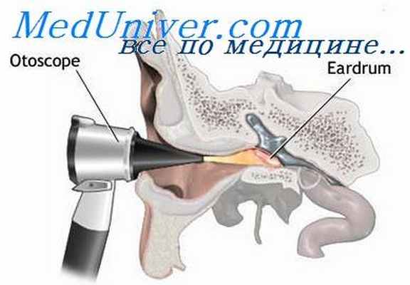 отоскопия