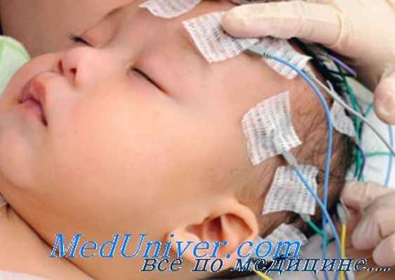 электроэнцефалография