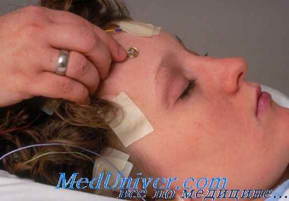 электроэнцефалография