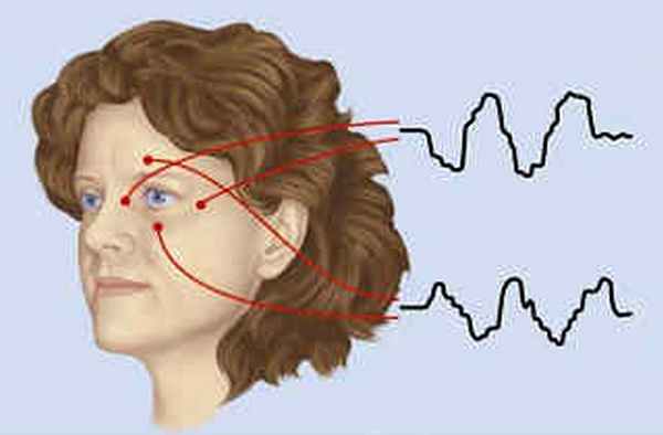 ЭФИ - электрофизиологическое исследование глаз