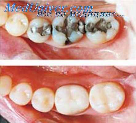 электрообезболивание