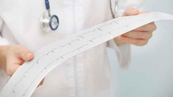 Электрокардиограмма