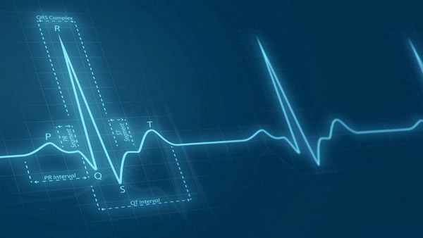 Нормальная ЭКГ