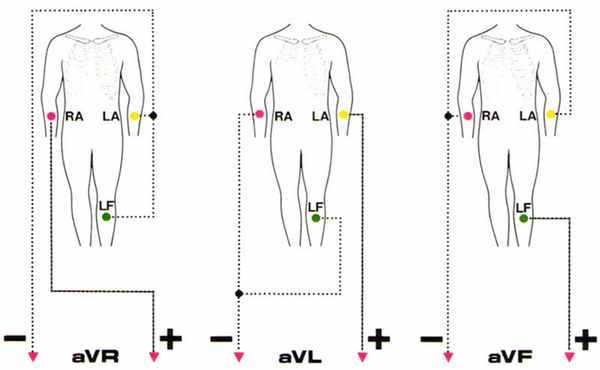 Алгоритм снятия ЭКГ-3