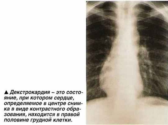 Инфографика 1