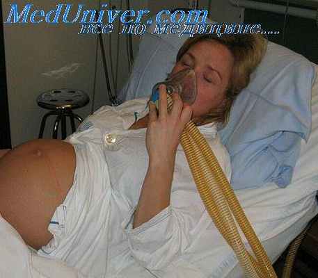 ингаляционный анестетик