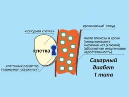 Эндокринные заболевания