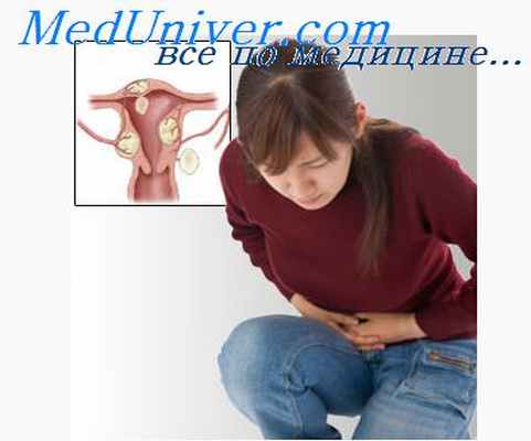 опухоли яичников