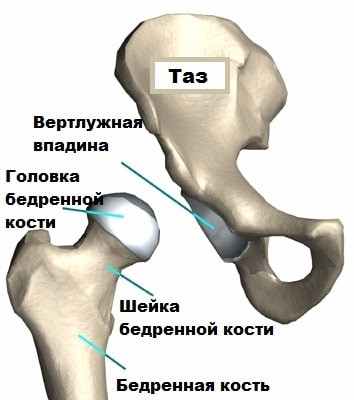 Эндопротезирование тазобедренного сустава