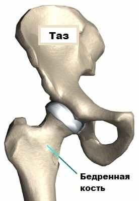 Эндопротезирование тазобедренного сустава