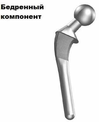 Эндопротезирование тазобедренного сустава