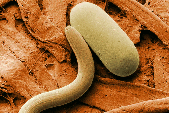 Энтеробиоз