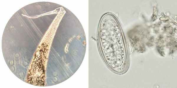 Яйца остриц