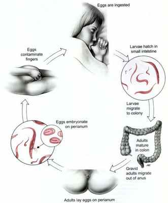 Механизм заражения энтеробиозом