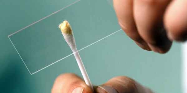 Энтеробиоз