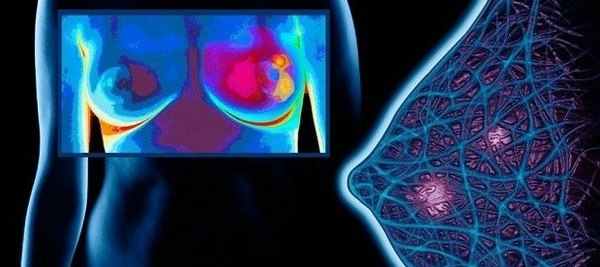 Лечение липомы молочной железы