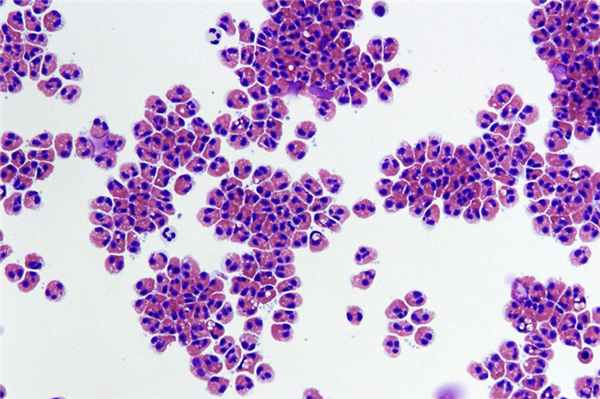 Эозинофилы — это одна из пяти разновидностей лейкоцитов, или белых кровяных телец