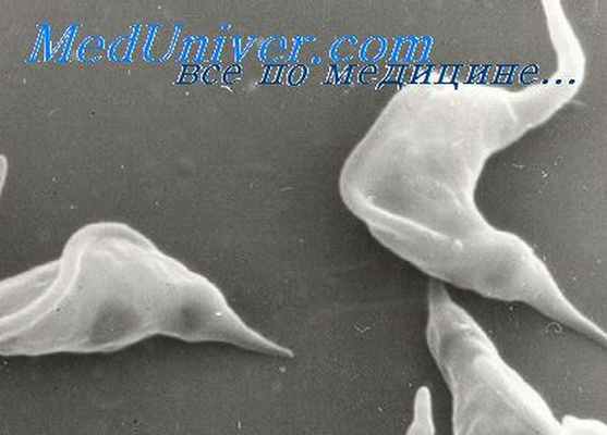 болезнь шагаса