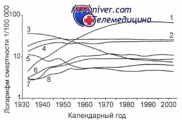 Эпидемиология гемобластозов - смертность