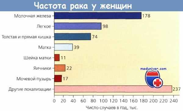 Частота рака женщин