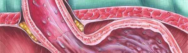 Гуморальный иммунитет и антигены системы HLA при заболеваниях поджелудочной железы