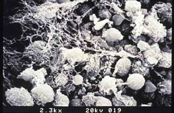 Колонии стволовых кроветворных клеток (электронная микроскопия)