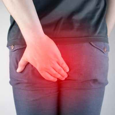 Парапроктит