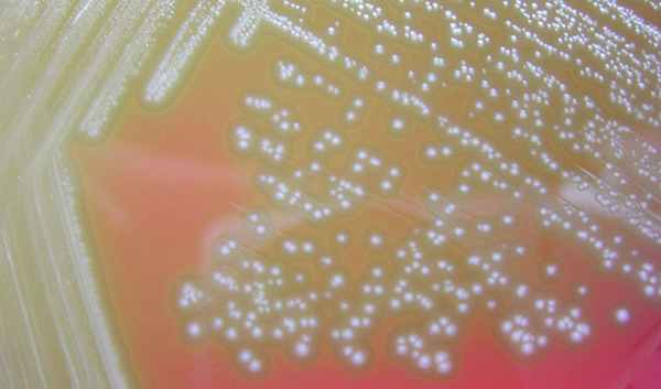 Streptococci viridans