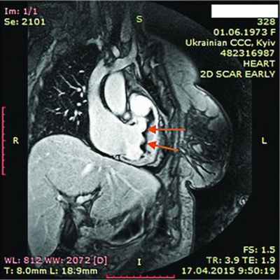 Рис11Без имени-1