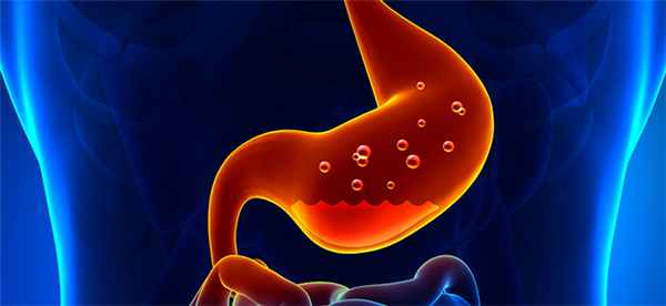 эзофагит - воспаление слизистой пищевода